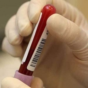 Tunceli’de HIV Virüsü Paniği